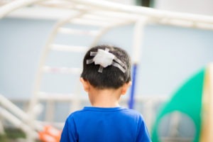 Head Injury Lawyer in Los Angeles | Free Consultations 24/7 Los angeles head injury lawyer