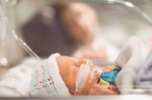 Birth Injury Lawyer in Los Angeles, CA | Simmrin Law Group | Call Us 24/7 a baby in the neonatal intensive care unit of a hospital