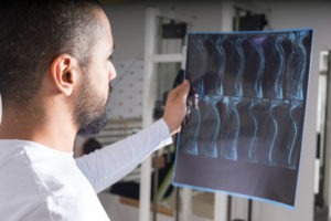 Spinal Cord Injury Lawyer in Los Angeles | Free Consultations 24/7 radiologist examining x-rays of spine