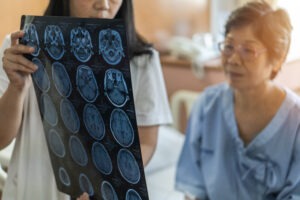 Brain Injury Lawyer in Burbank | Free Consultations 24/7 burbank brain injury lawyer
