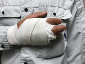Dog Bite Lawyer in Irvine | Free Consultations 24/7 male worker with injured hand
