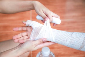 Burn Injury Lawyer in Downey | Free Consultations 24/7 burn victim getting hand taped up