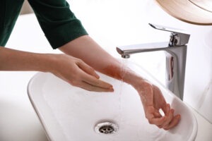 Burn Injury Lawyer in Costa Mesa | Free Consultations 24/7 woman-washing-burn-in-sink